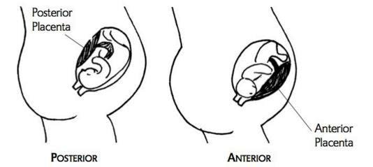 anterior posterior placenta