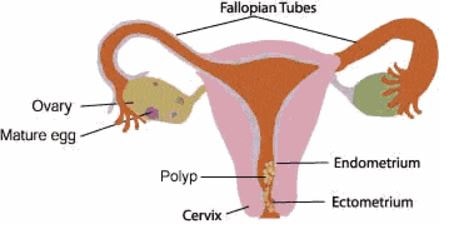 cervical polyps