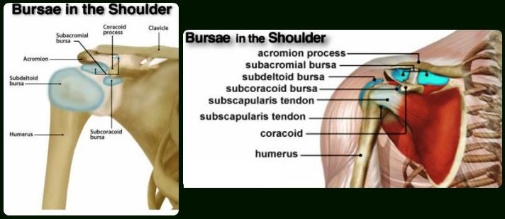 shoulder bursitis bursae location anatomy