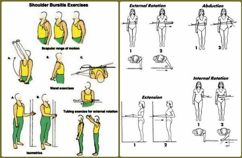 shoulder bursitis exercises