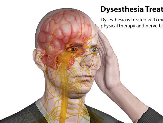 dysesthesia-definition-symptoms-treatment
