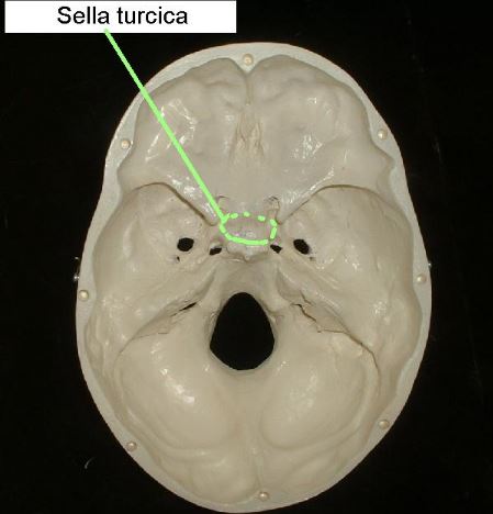 Sella Turcica-location-in-skull-mid-section-view