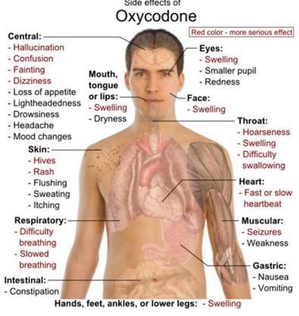 side effects of oxycodone