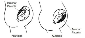 Anterior Placenta Risks Complications Symptoms Causes   Anterior Posterior Placenta 300x134 