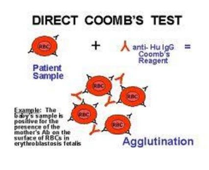 direct coombs test