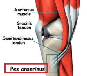 Pes Anserine Bursitis Treatment Symptoms Causes Diagnosis