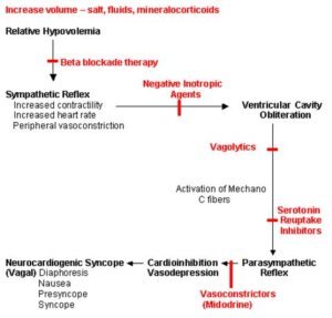 NeuroCardiogenic Syncope - Symptoms, Treatment, What is, Definition