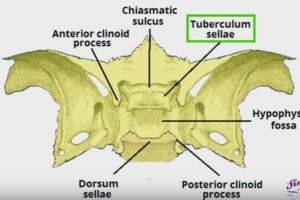 Sella Turcica - Bone, Function, Site, Location, Anatomy, Empty Sella