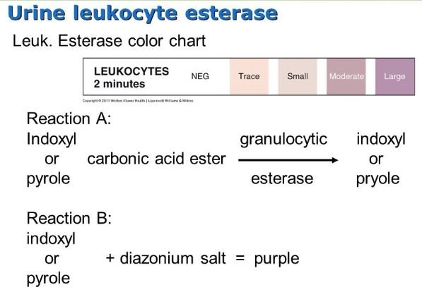 Leukocyte Esterase Urine What Is Clinical Significance 8344