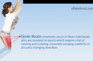 Groin strain definition