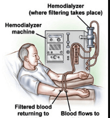 Hypovolemia