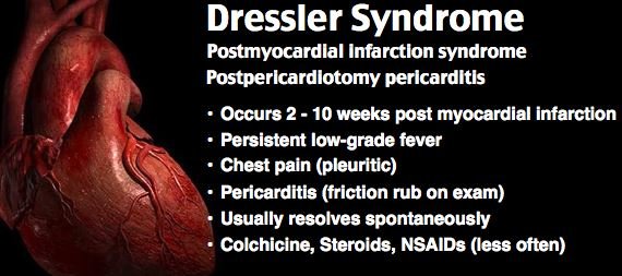 Dressler Syndrome