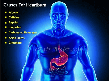 Heartburn causes