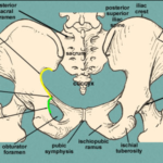 Ischial Spine (pelvic bone)